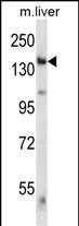 1 - Mouse Eif2ak4 Antibody (C-term) AP14713b