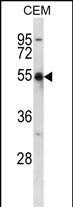 1 - KCNA2 Antibody (C-term) AP14749b