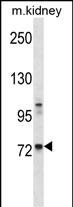 1 - Mouse Tec Antibody (Center) AP14777c