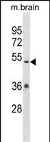 1 - Mouse Camkv Antibody (N-term) AP14781a