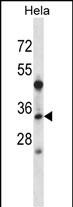1 - LAT2 Antibody (Center) AP14803c
