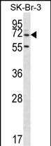 1 - ZNF398 Antibody (Center) AP14859c