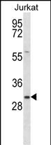 1 - TMED8 Antibody (Center) AP14894c