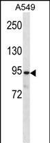 1 - PKP3 Antibody (C-term) AP14907b