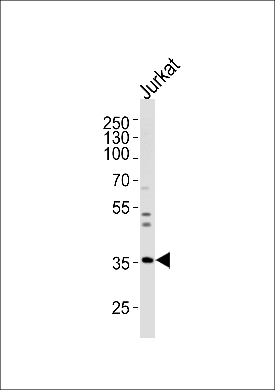 1 - GLRB Antibody (N-term) AP14931a