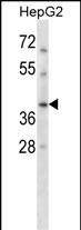 1 - RAD51C Antibody (Center) AP14962c