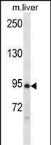 1 - Mouse Dclk1 Antibody (N-term) AP14964a