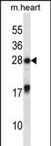 1 - MXI1 Antibody (Center) AP14974c