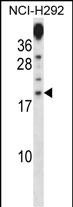 1 - PRR15 Antibody (C-term) AP14978B