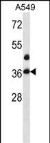 1 - LASP1 Antibody (Center) AP14992c