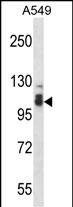 1 - SMEK2 Antibody (C-term) AP16035b