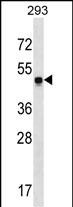1 - SNX17 Antibody (N-term) AP16064a