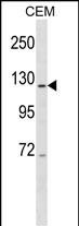 1 - PRPF6 Antibody (C-term) AP16097b