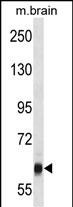 1 - VPS45 Antibody (C-term) AP16102b