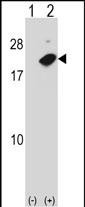 1 - NUDT2 Antibody (Center) AP16121c