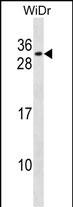 1 - RFXANK Antibody (Center) AP16143c