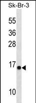 1 - C22orf26 Antibody (C-term) AP16157b