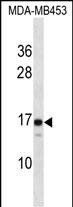 1 - LIM2 Antibody (C-term) AP16239b
