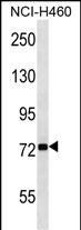 1 - ZNF441 Antibody (N-term) AP16311a