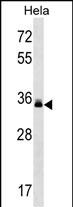 1 - LMAN2 Antibody (C-term) AP16328b