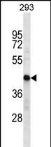 1 - HSDL2 Antibody (Center) AP16340c