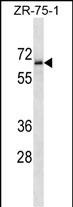 1 - TM117 Antibody (C-term) AP16341b