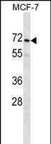 1 - PRAMEF2 Antibody (C-term) AP16344b