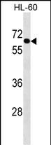 1 - AIM1L Antibody (C-term) AP16345b