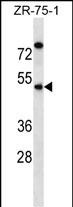 1 - EME2 Antibody (C-term) AP16348b