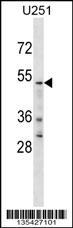 1 - YTHD2 Antibody (C-term) AP16373b