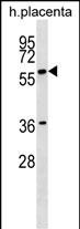 1 - GAB3 Antibody (N-term) AP16384a