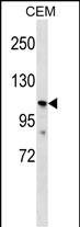 1 - PKD2L1 Antibody (N-term) AP16416a