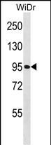 1 - GNL2 Antibody (N-term) AP16458a