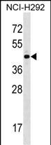 1 - ZNF436 Antibody (N-term) AP16509a