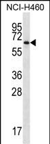 1 - ZBTB46 Antibody (Center) AP16533c
