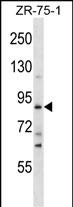 1 - SLITRK4 Antibody (C-term) AP16537b