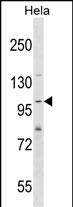 1 - SH3PXD2A Antibody (N-term) AP16560a