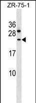 1 - CCDC140 Antibody (N-term) AP16571a