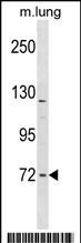 1 - FNBP1L Antibody (Center) AP16582c