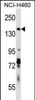 1 - DIAPH3 Antibody (C-term) AP16587b