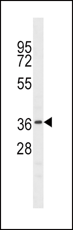 1 - NKX6-1 Antibody (C-term) AP16589b