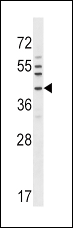 1 - NKX6-1 Antibody (C-term) AP16589b