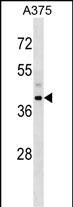 1 - SNUPN Antibody (Center) AP16617c