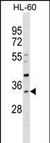 1 - SULT1B1 Antibody (C-term) AP16645b