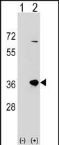1 - SULT1B1 Antibody (C-term) AP16645b