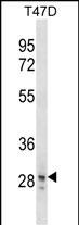 1 - SNAI3 Antibody (N-term) AP16689a
