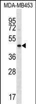 1 - HAPLN3 Antibody (Center) AP16704c