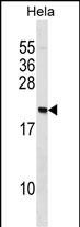 1 - PAIP2 Antibody (N-term) AP16769a