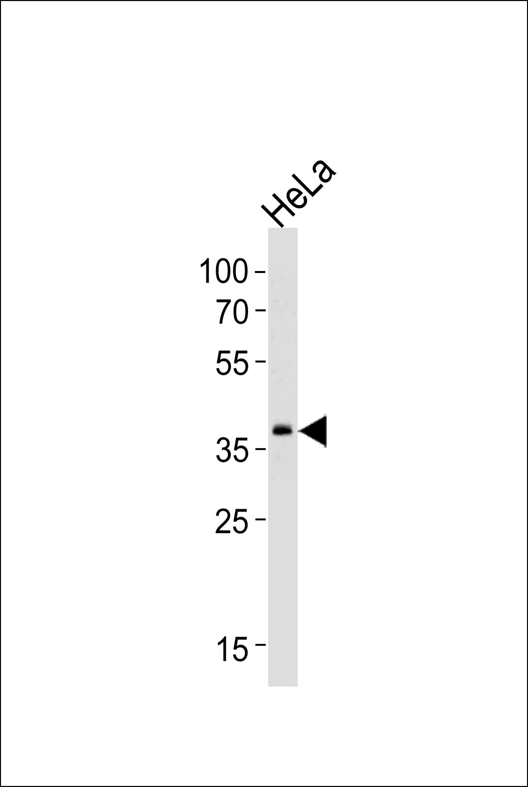 1 - SRPX Antibody (Center) AP16813c