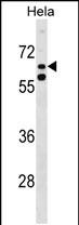 1 - KLHL38 Antibody (N-term) AP16828a